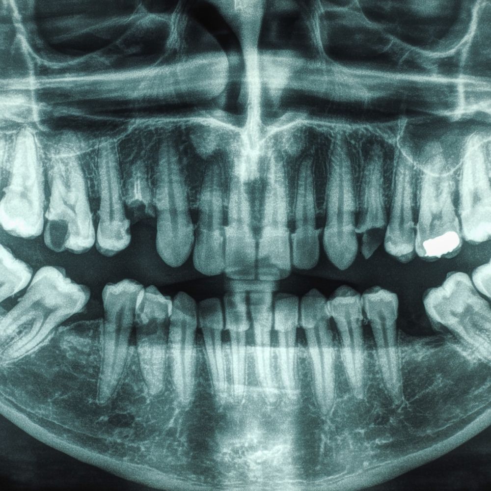 Radiographic Oral Examination-oradent.gr