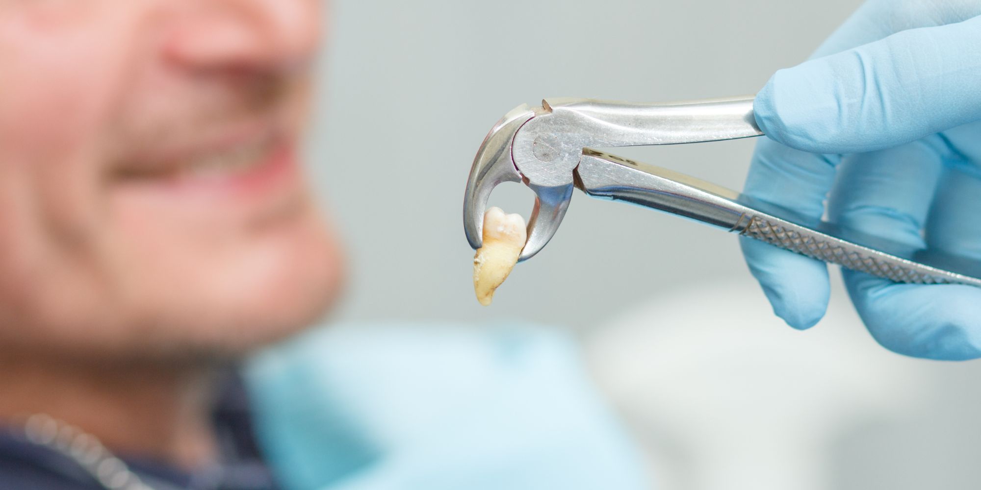 Tooth Extraction-oradent.gr
