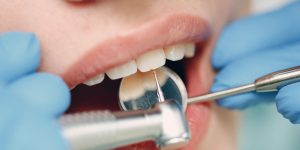How is teeth cleaning done?-oradent.gr
