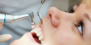 Καθαρισμός δοντιών: Όσα πρέπει να γνωρίζεις-oradent.gr