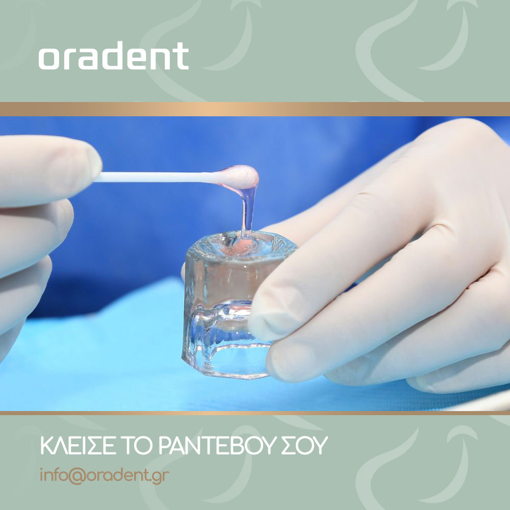 Blog Fluoride in the teeth-oradent.gr