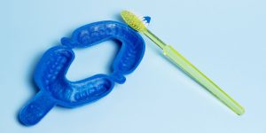 What is dental fluoridation?-oradent.gr