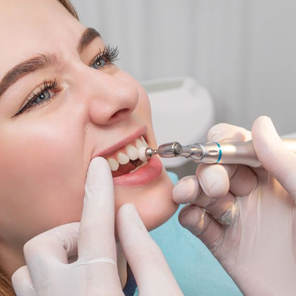 Teeth Cleaning and Polishing-oradent.gr