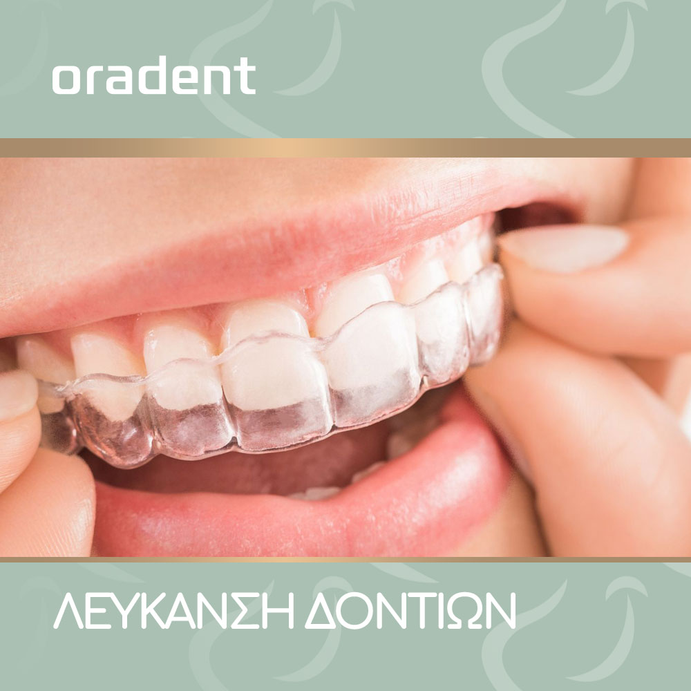 Blog Teeth Whitening-oradent.gr