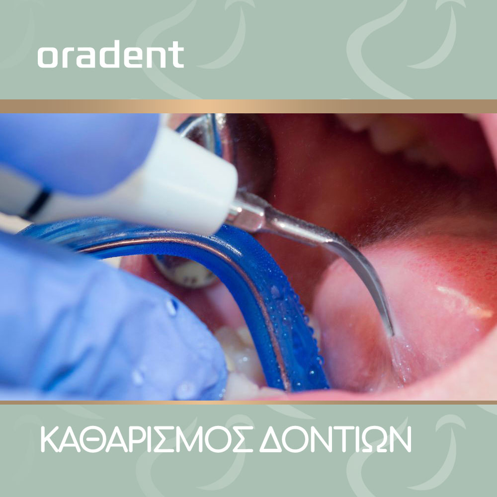 Blog Καθαρισμός Δοντιών-oradent.gr