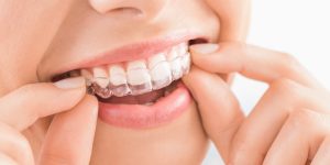 Does teeth whitening hurt?-oradent.gr