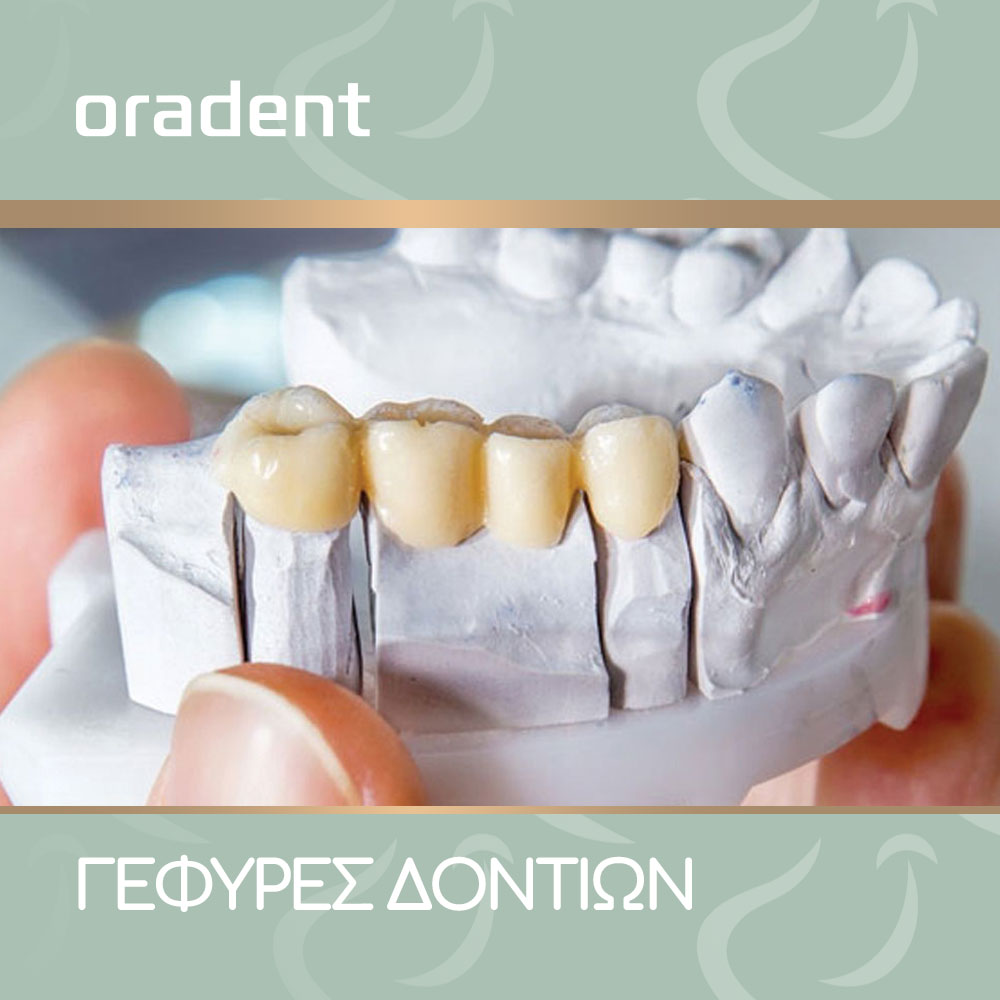 Blog Dental bridge-oradent.gr