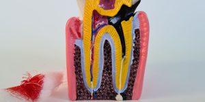 What is tooth denervation?-oradent.gr